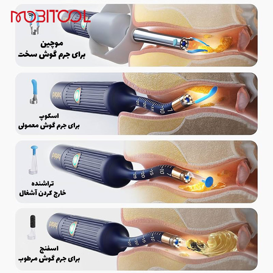 گوش پاک کن بیبرد