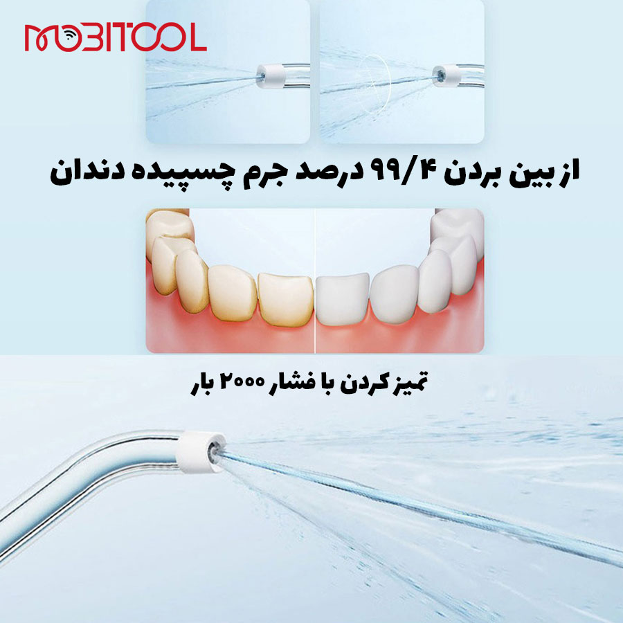خرید واترجت دندان خرید واترجت دندان